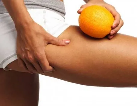 Cellulite gambe