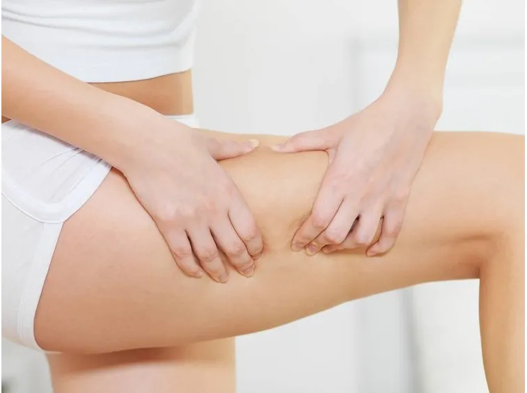 Rimedi cellulite