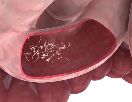 vermi intestinali
