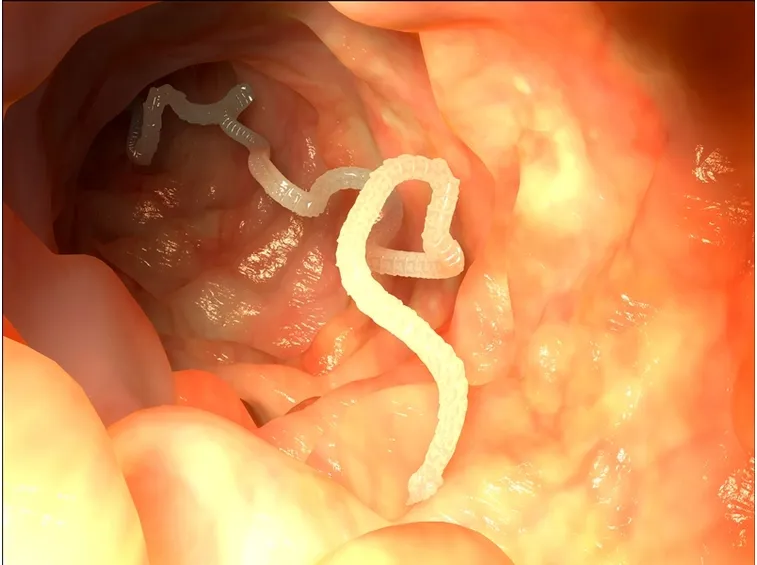 vermi intestinali