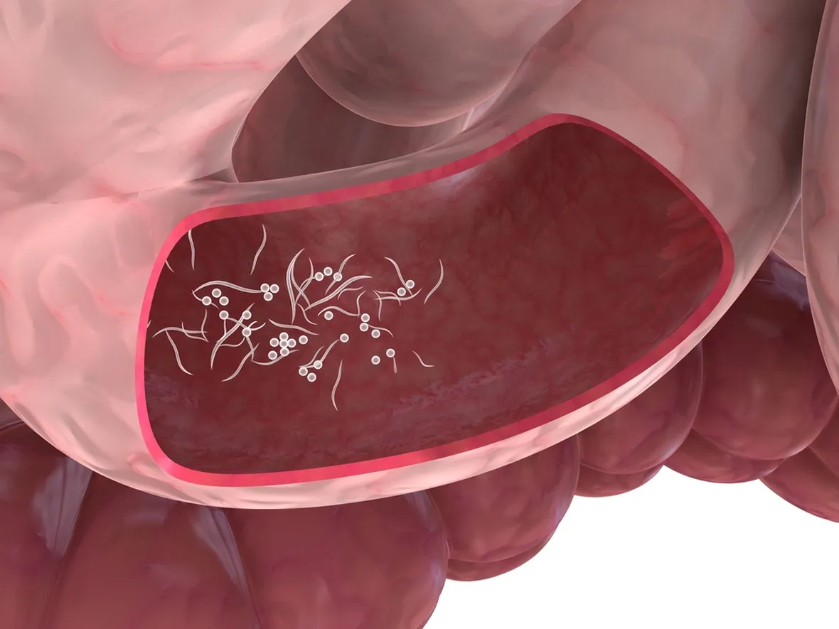vermi intestinali