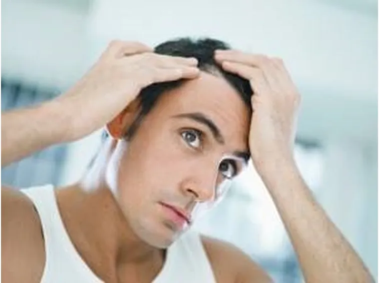 Alopecia