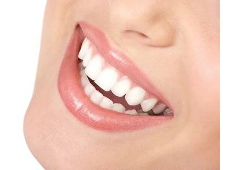 Sbiancamento dentale 