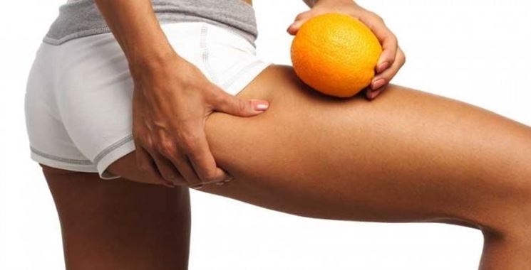 Cellulite gambe